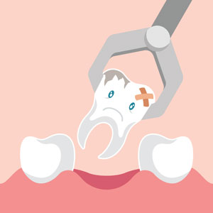 tooth extraction