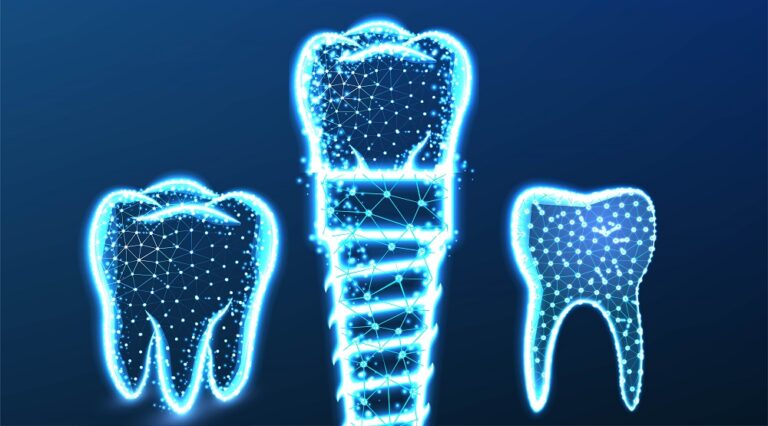 Implant