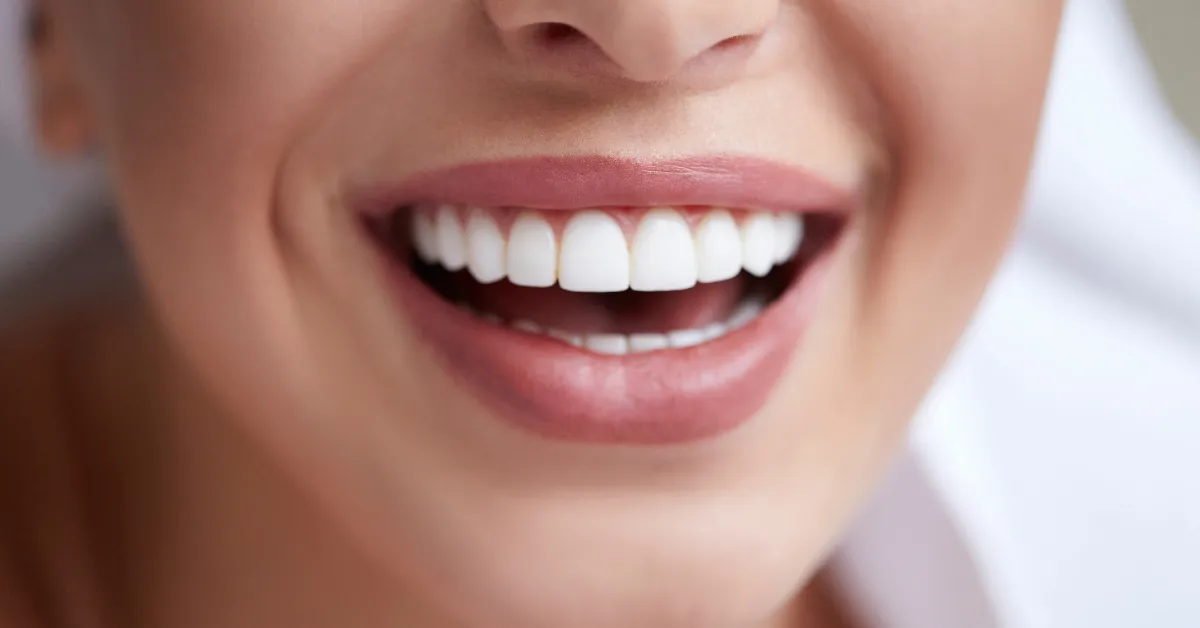 A woman with straight teeth smiling brightly