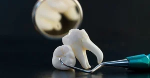 Wisdom Teeth