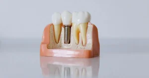 Dentures