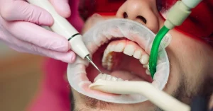 Bruxism