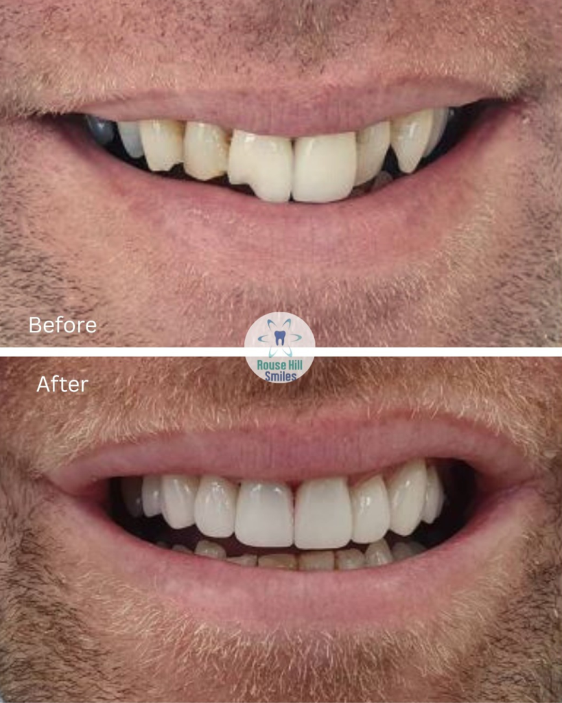 Untitled design (60) (1)