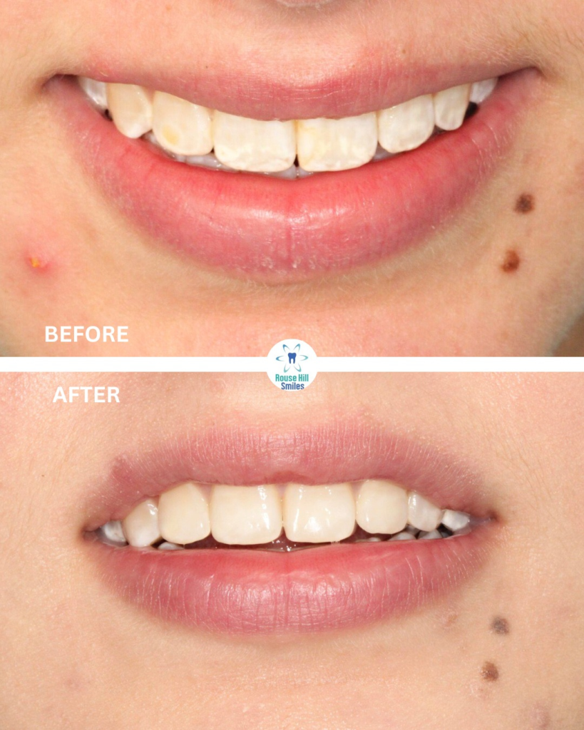 Untitled design (62) (1)