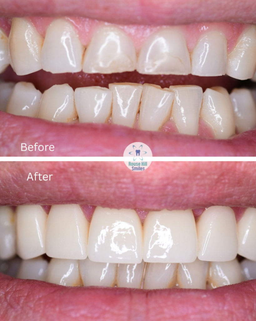 Untitled design (64) (1)