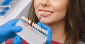 porcelain Veneers