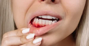 gum health