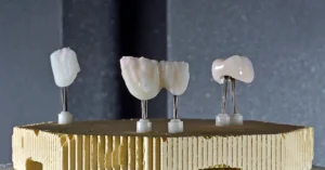 dental crown