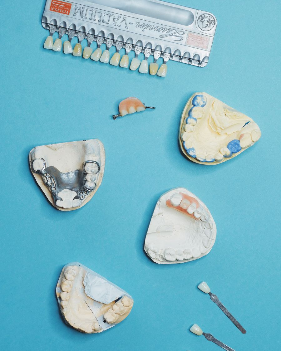 Dental moulds and prosthetics used to make custom restorations